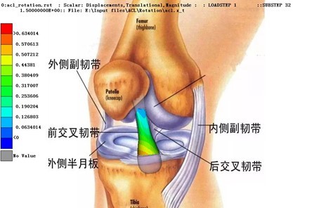 前交叉韧带生物医学应力分析